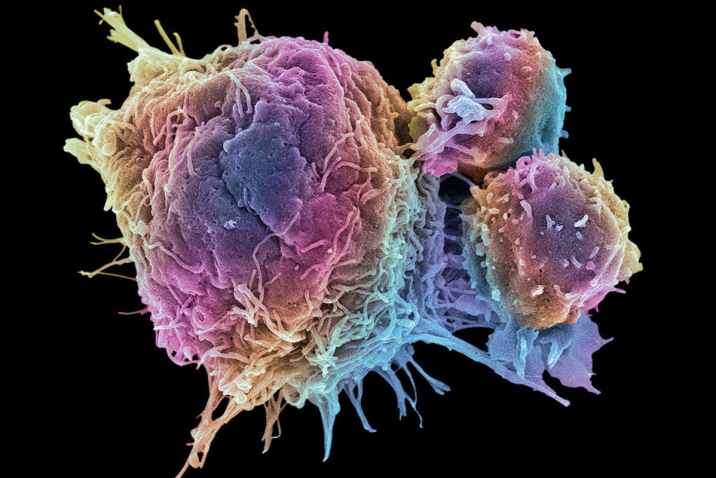 Yeni Kan Testi Sistemi ile 50 Farklı Kanser Tipi Teşhis Ediliyor